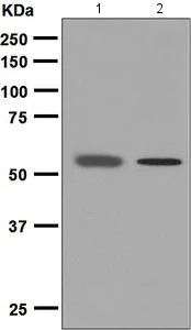 Western blot - Anti-PIAS2 antibody [EPR2582(2)] (AB126601)