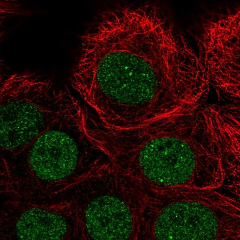 Immunocytochemistry/ Immunofluorescence - Anti-PIAS3 antibody (AB221901), expandable thumbnail