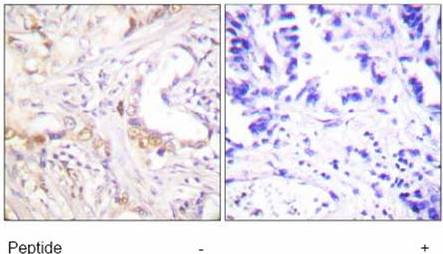 Immunohistochemistry (Formalin/PFA-fixed paraffin-embedded sections) - Anti-PIAS3 antibody (AB58406)