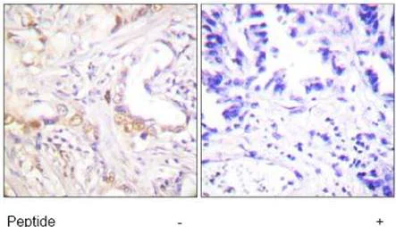 Immunohistochemistry (Formalin/PFA-fixed paraffin-embedded sections) - Anti-PIAS3 antibody (AB58406)