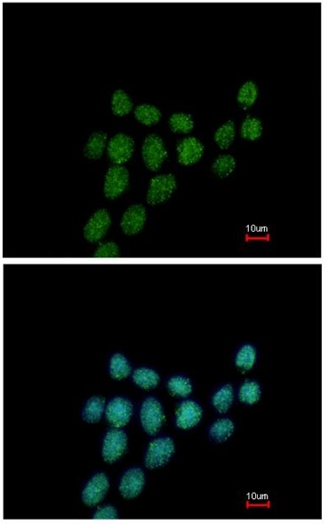 Immunocytochemistry/ Immunofluorescence - Anti-PIBF antibody (AB151491)