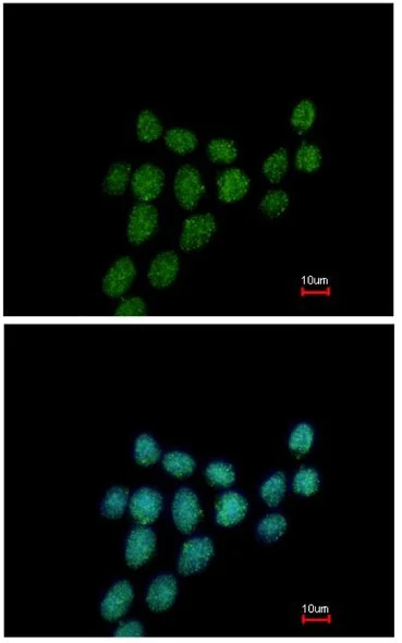 Immunocytochemistry/ Immunofluorescence - Anti-PIBF antibody (AB151491)