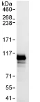 Immunoprecipitation - Anti-PIBF antibody (AB72118)