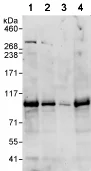 Western blot - Anti-PIBF antibody (AB72118)