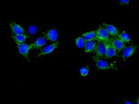 Immunocytochemistry/ Immunofluorescence - Anti-PICALM antibody [EPR12177] (AB172962)
