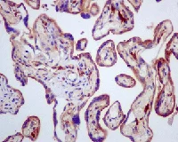 Immunohistochemistry (Formalin/PFA-fixed paraffin-embedded sections) - Anti-PICALM antibody [EPR12177] (AB172962)