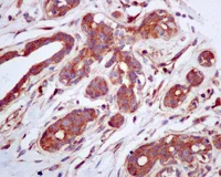 Immunohistochemistry (Formalin/PFA-fixed paraffin-embedded sections) - Anti-PICALM antibody [EPR12177] (AB172962)