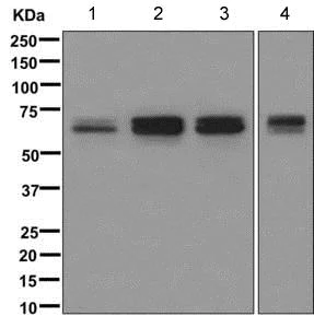 Western blot - Anti-PICALM antibody [EPR12177] (AB172962)