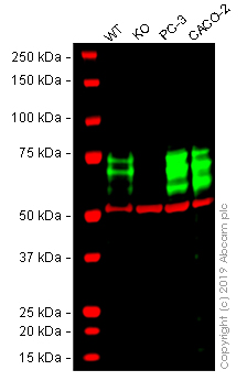 Western blot - Anti-PICALM antibody [EPR12177] - BSA and Azide free (AB249736), expandable thumbnail