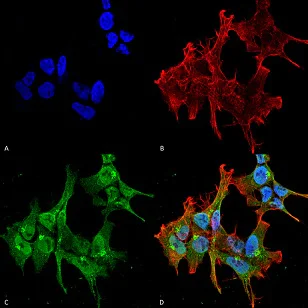 Immunocytochemistry/ Immunofluorescence - Anti-Piccolo antibody [6H9-B6] (AB101654)