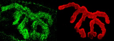 Immunohistochemistry (Formalin/PFA-fixed paraffin-embedded sections) - Anti-Piccolo antibody (AB110427)