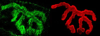Immunohistochemistry (Formalin/PFA-fixed paraffin-embedded sections) - Anti-Piccolo antibody (AB110427)