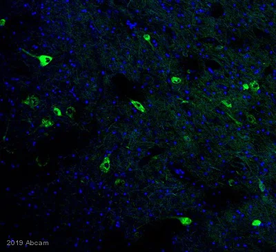 Immunohistochemistry (Formalin/PFA-fixed paraffin-embedded sections) - Anti-Piccolo antibody (AB20664)