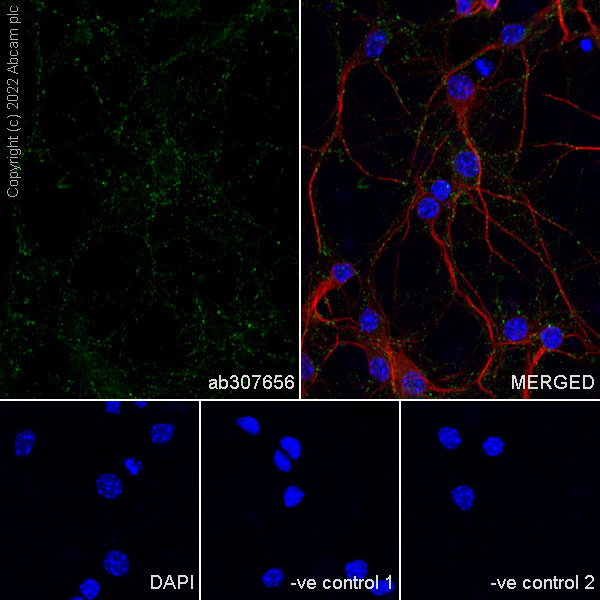 Immunocytochemistry/ Immunofluorescence - Anti-Piccolo antibody [EPR26840-80] - BSA and Azide free (ab307657), expandable thumbnail