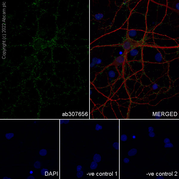 Immunocytochemistry/ Immunofluorescence - Anti-Piccolo antibody [EPR26840-80] - BSA and Azide free (ab307657), expandable thumbnail