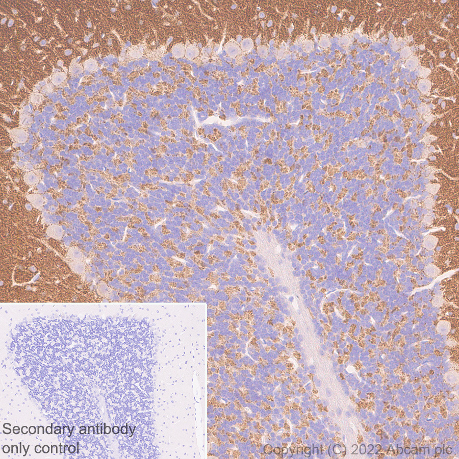 Immunohistochemistry (Formalin/PFA-fixed paraffin-embedded sections) - Anti-Piccolo antibody [EPR26840-80] - BSA and Azide free (AB307657), expandable thumbnail