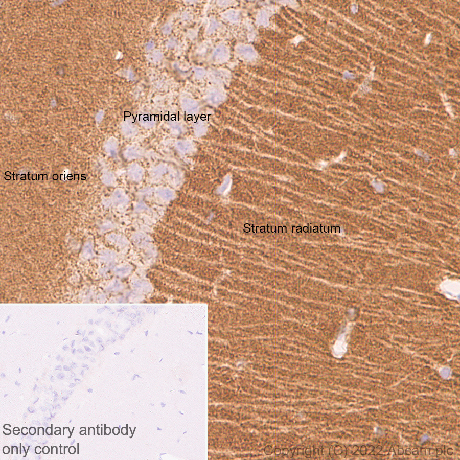 Immunohistochemistry (Formalin/PFA-fixed paraffin-embedded sections) - Anti-Piccolo antibody [EPR26840-80] - BSA and Azide free (AB307657), expandable thumbnail