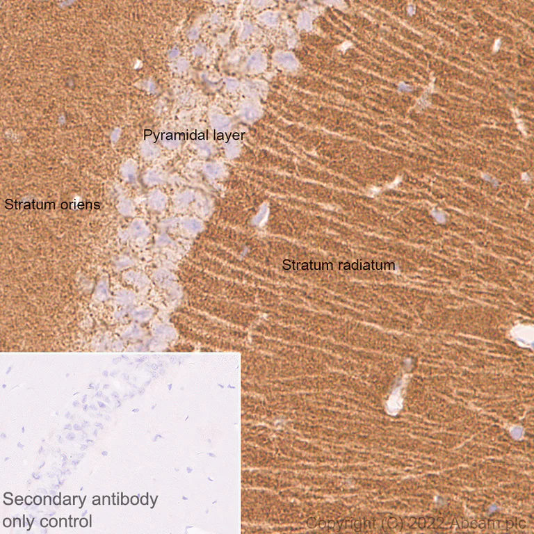 Immunohistochemistry (Formalin/PFA-fixed paraffin-embedded sections) - Anti-Piccolo antibody [EPR26840-80] - BSA and Azide free (AB307657)