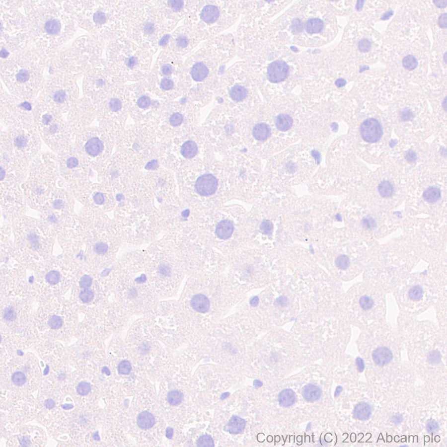 Immunohistochemistry (Formalin/PFA-fixed paraffin-embedded sections) - Anti-Piccolo antibody [EPR26840-80] - BSA and Azide free (AB307657), expandable thumbnail