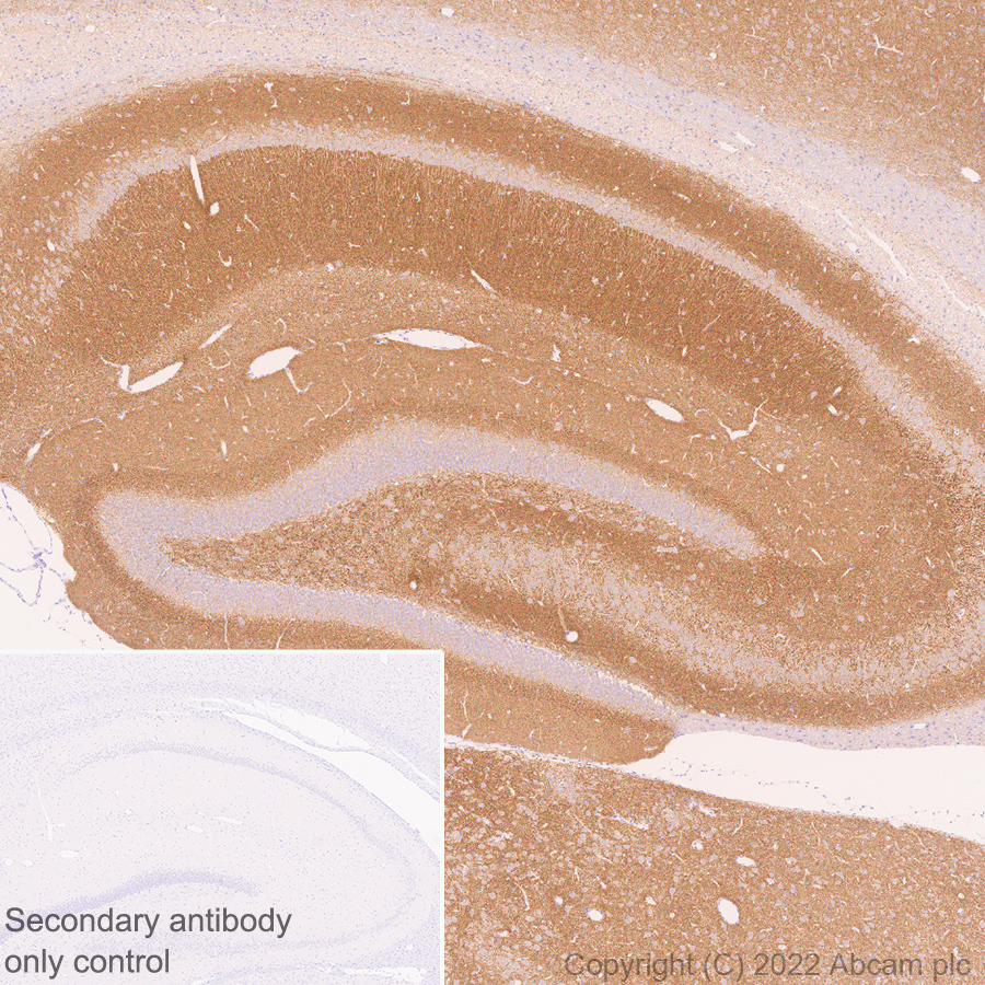 Immunohistochemistry (Formalin/PFA-fixed paraffin-embedded sections) - Anti-Piccolo antibody [EPR26840-80] - BSA and Azide free (AB307657), expandable thumbnail