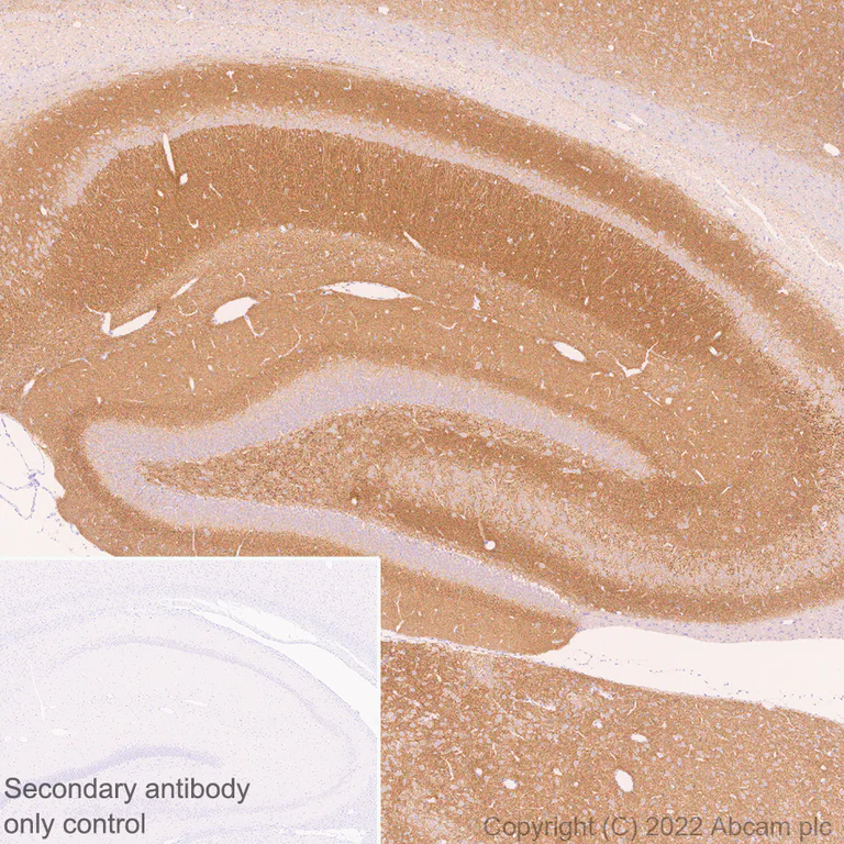 Immunohistochemistry (Formalin/PFA-fixed paraffin-embedded sections) - Anti-Piccolo antibody [EPR26840-80] - BSA and Azide free (AB307657)