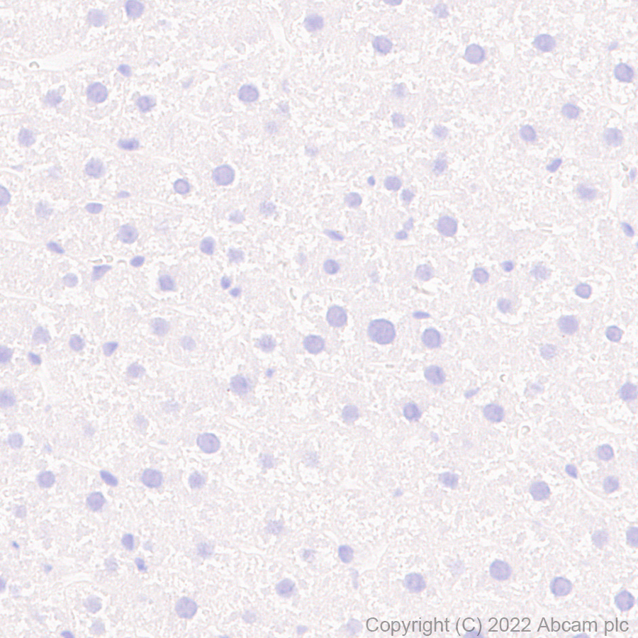 Immunohistochemistry (Formalin/PFA-fixed paraffin-embedded sections) - Anti-Piccolo antibody [EPR26840-80] - BSA and Azide free (AB307657), expandable thumbnail