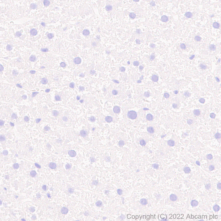 Immunohistochemistry (Formalin/PFA-fixed paraffin-embedded sections) - Anti-Piccolo antibody [EPR26840-80] - BSA and Azide free (AB307657)