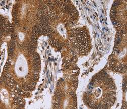 Immunohistochemistry (Formalin/PFA-fixed paraffin-embedded sections) - Anti-PICH antibody (AB197925), expandable thumbnail