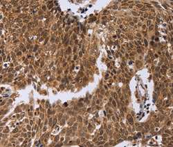 Immunohistochemistry (Formalin/PFA-fixed paraffin-embedded sections) - Anti-PICH antibody (AB197925), expandable thumbnail