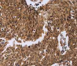 Immunohistochemistry (Formalin/PFA-fixed paraffin-embedded sections) - Anti-PICH antibody (AB197925)
