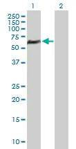 Western blot - Anti-PICH antibody (AB88560)