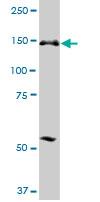 Western blot - Anti-PICH antibody (AB88560)