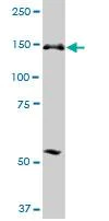 Western blot - Anti-PICH antibody (AB88560)