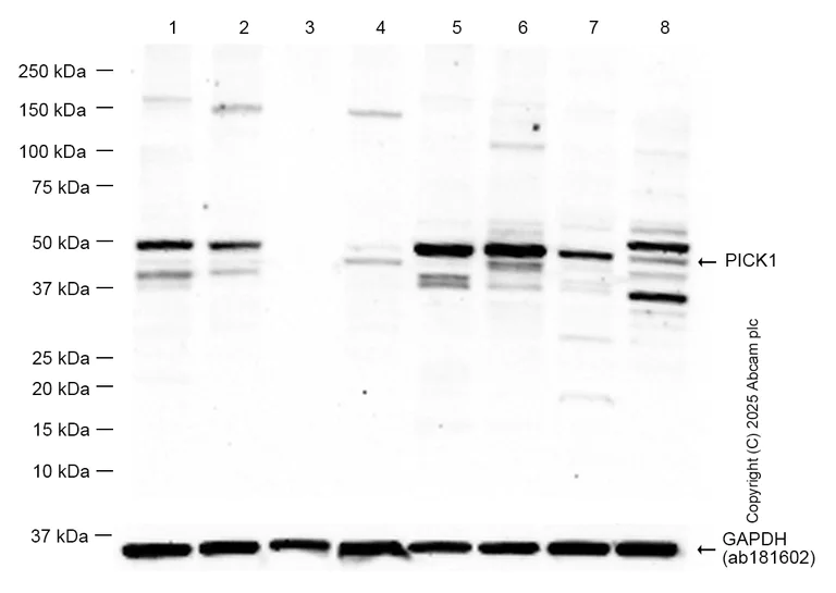 Western blot - Anti-PICK1 antibody [EPR25155-48] - BSA and Azide free (AB290742)