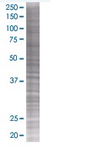 PICK1 overexpression 293T lysate (whole cell)