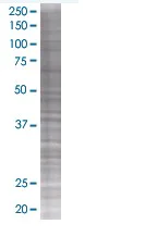 SDS-PAGE - PICK1 overexpression 293T lysate (whole cell) (AB94269)