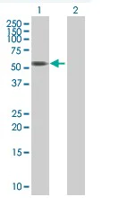 Western blot - PICK1 overexpression 293T lysate (whole cell) (AB94269)