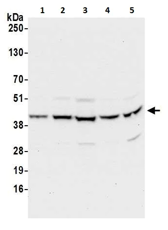 Western blot - Anti-PICOT antibody (AB226396)