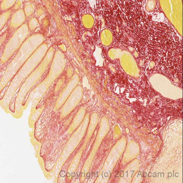 Immunohistochemistry (Formalin/PFA-fixed paraffin-embedded sections) - Picro-Sirius Red Solution (AB246832)