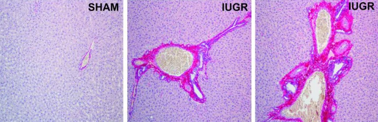 Immunohistochemistry (Formalin/PFA-fixed paraffin-embedded sections) - Picro Sirius Red Stain Kit (Connective Tissue Stain) (AB150681)