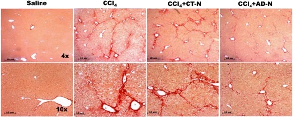 Immunohistochemistry (Formalin/PFA-fixed paraffin-embedded sections) - Picro Sirius Red Stain Kit (Connective Tissue Stain) (AB150681)