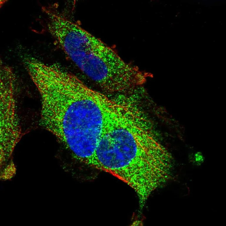 Immunocytochemistry/ Immunofluorescence - Anti-PID1 antibody (AB251842)