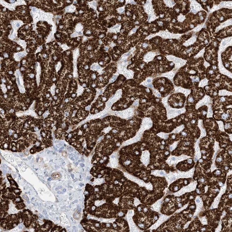 Immunohistochemistry (Formalin/PFA-fixed paraffin-embedded sections) - Anti-PID1 antibody (AB251842)