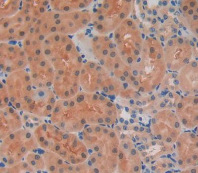 Immunohistochemistry (Formalin/PFA-fixed paraffin-embedded sections) - Anti-PIDD1 antibody (AB231315)