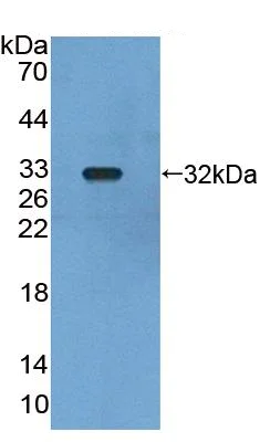 Western blot - Anti-PIDD1 antibody (AB231315)