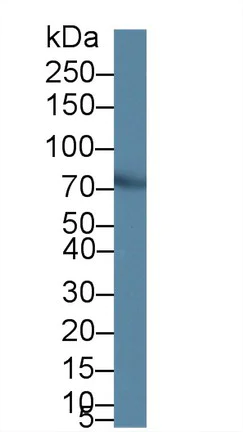 Western blot - Anti-PIDD1 antibody (AB231315)