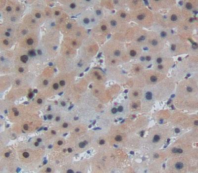 Immunohistochemistry (Formalin/PFA-fixed paraffin-embedded sections) - Anti-PIDD1 antibody (AB232773)