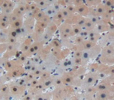 Immunohistochemistry (Formalin/PFA-fixed paraffin-embedded sections) - Anti-PIDD1 antibody (AB232773)