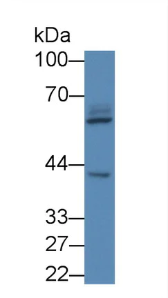 Western blot - Anti-PIDD1 antibody (AB232773)