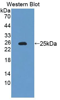Western blot - Anti-PIDD1 antibody (AB232773)